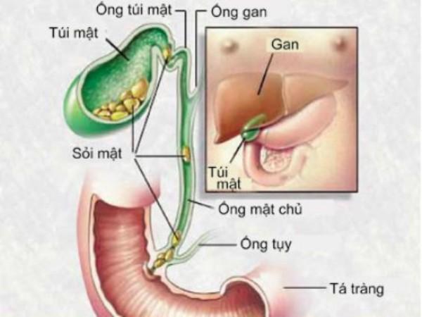 10 dấu hiệu nhắc bạn cần đi kiểm tra sức khỏe cho túi mật - 1