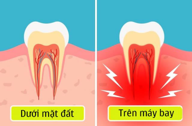 9 thay đổi cơ thể khi đi máy bay mà bạn không hề biết, 4/9 là nỗi ám ảnh của chị em - 7