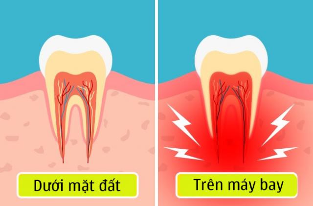 9 thay đổi cơ thể khi đi máy bay mà bạn không hề biết, 4/9 là nỗi ám ảnh của chị em - 7