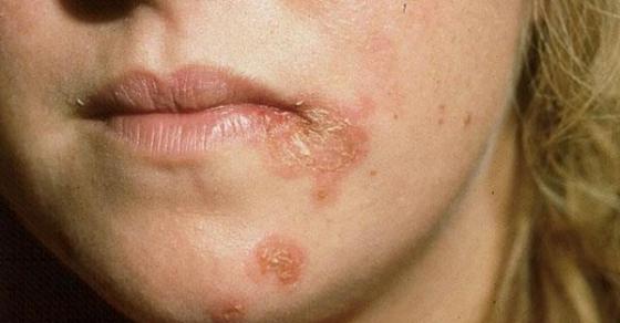 132 4 7 Dau Hieu Som Canh Bao Tim Dang Gap Van De Nghiem Trong