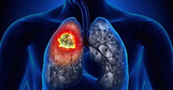 132 1 Dau Hieu Canh Bao Phoi Co Van De