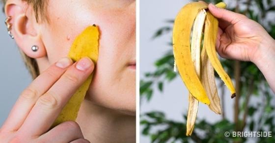 132 1 Chuoi Va Nhung Loi Ich Bat Ngo Tu Vo Chuoi