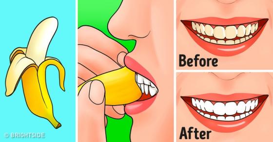 132 7 Chuoi Va Nhung Loi Ich Bat Ngo Tu Vo Chuoi