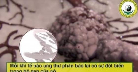 132 1 Toat Mo Hoi Khi Tan Mat Chung Kien Te Bao Ung Thu Di Chuyen Nhu Pha Trong Co The