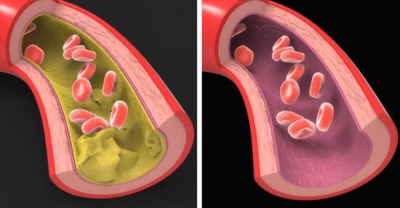 132 1 12 Loi Ich Doi Voi Co The Neu Ban Dung Dau Ca Moi Ngay
