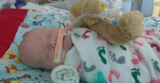 132 1 Sau Cai Om Cua Bo Be 5 Tuan Tuoi Bong Bi Ngo Doc Phai Nhap Vien Cap Cuu