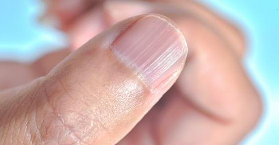 132 4 Cac Dau Hieu Cua Co The Canh Bao Tinh Trang Suc Khoe Cua Ban