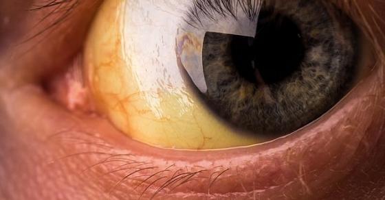 132 6 Cac Dau Hieu Cua Co The Canh Bao Tinh Trang Suc Khoe Cua Ban