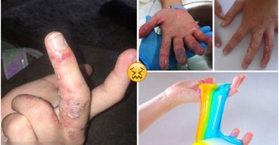 132 1 Do Choi Slime  Chat Nhon Ma Quai Khien Tre Hong Ngon Tay Gay Vo Sinh