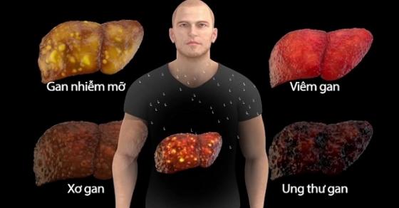 132 1 Ban Co Dang Tu Pha Huy Gan Cua Minh Moi Ngay Bang Nhung Thoi Quen Rat Nhieu Nguoi Mac Phai Nay Khong