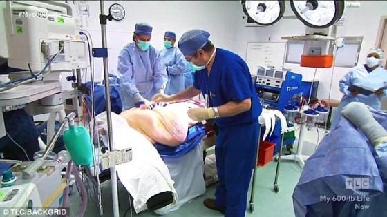132 10 Co Tung Nang Den 3 Ta Sau Khi No Luc Giam 200 Kg Nhieu Nguoi Muon Hen Ho