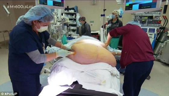 132 7 Co Tung Nang Den 3 Ta Sau Khi No Luc Giam 200 Kg Nhieu Nguoi Muon Hen Ho