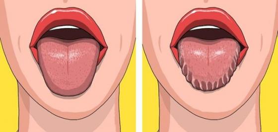 132 1 7 Dau Hieu Tren Co The Tiet Lo Suc Khoe Co Van De