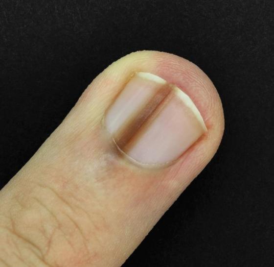 132 2 7 Dau Hieu Tren Co The Tiet Lo Suc Khoe Co Van De