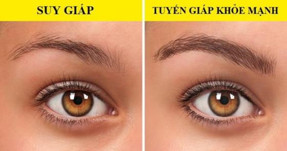 132 5 7 Dau Hieu Tren Co The Tiet Lo Suc Khoe Co Van De