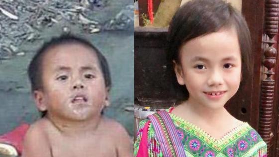 132 1 Em Be Muong Lat Bi Liet 2 Chan Cuoi Rang Ro Trong Hinh Anh Moi Nhat