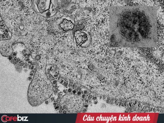 132 2 Bac Si Bv Cho Ray Giai Dap Ve Virus Corona Lay Nhiem Theo Co Che Nao Qua Duong Khong Khi Hay Duong An Uong