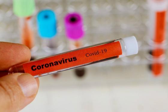 132 1 Cach Tu Kiem Tra Xem Co Bi Nhiem Virus Covid 19 Khong