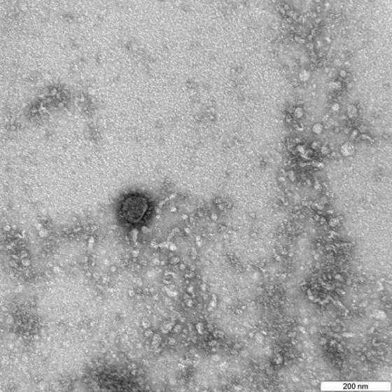 Nga giải mã thành công bộ gene của virus corona