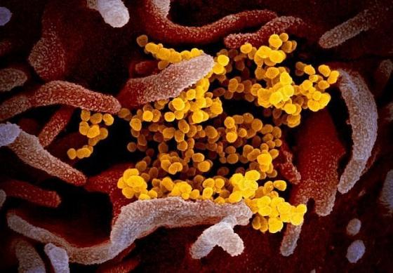 132 1 Nga Phat Trien Thiet Bi Phat Hien Virus Sars Cov 2 Trong Khong Khi