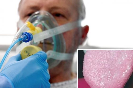 132 1 Bac Si Canh Bao Trieu Chung Moi Tren Luoi Cua Covid 19