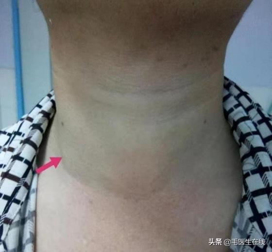 132 2 O Nhung Nguoi Thuong Xuyen Tuc Gian Tren Co The Xuat Hien 3 To 3 It Canh Bao Can Benh Nguy Hiem