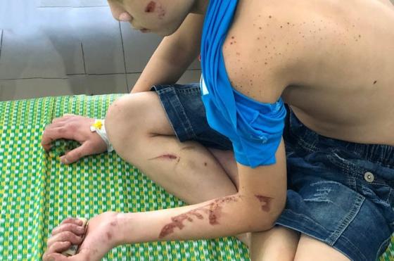 132 3 Nguoi Cha Bi Tam Than Va Gia Canh Ban Han Den Tham Thuong Cua Cau Be 15 Tuoi