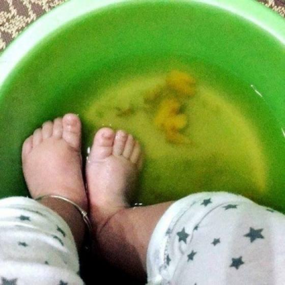 132 2 4 Sai Lam Khi Su Dung Nuoc Nong Nhieu Nguoi Dang Mac Phai Co The Tan Pha Suc Khoe