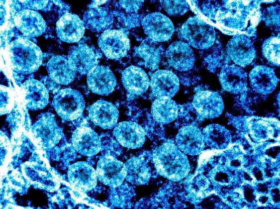 2 Phat Hien Virus Moi Giong Ncov