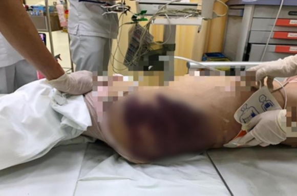 2 Vu Be Gai 8 Tuoi Tu Vong Hoi Bao Ve Tre Em De Nghi Doi Toi Danh Di Ghe Va Khoi To Nguoi Cha