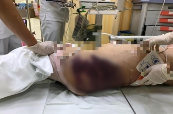 2 Be Gai 8 Tuoi Bi Hanh Ha Toi Chet Camera To Cao Nguoi Cha Mau Lanh