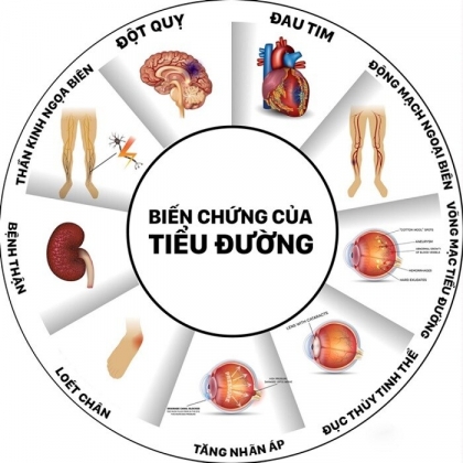 4 F0 Khoi Covid 19 Co Nhieu Nguy Co Mac Tieu Duong Tuyp 2