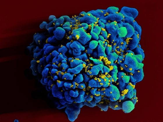 Bệnh nhân được chữa khỏi HIV nhờ ghép tế bào gốc