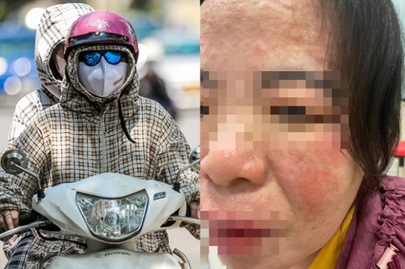1 Tin Loi Nhan Vien Spa Dung Vien Chong Nang Phoi Mat Da Van Dep Va Cai Ket